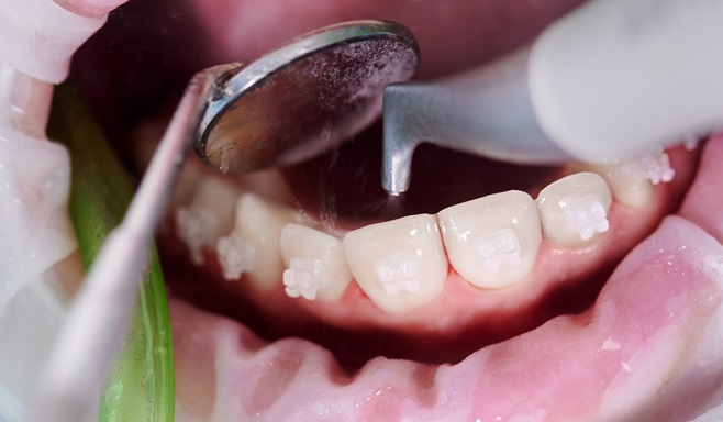 Preventive Dental Care Tips for Spring Hill Residents