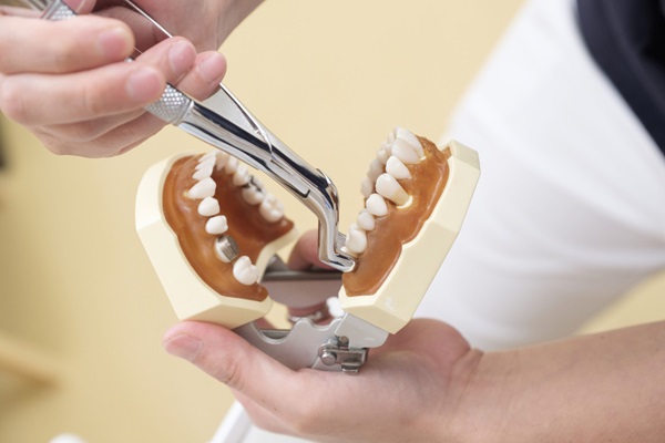 Symptoms And Treatment Options For Wisdom Teeth Extractions